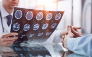 How is Evidence Preserved in a Brain Injury Case?